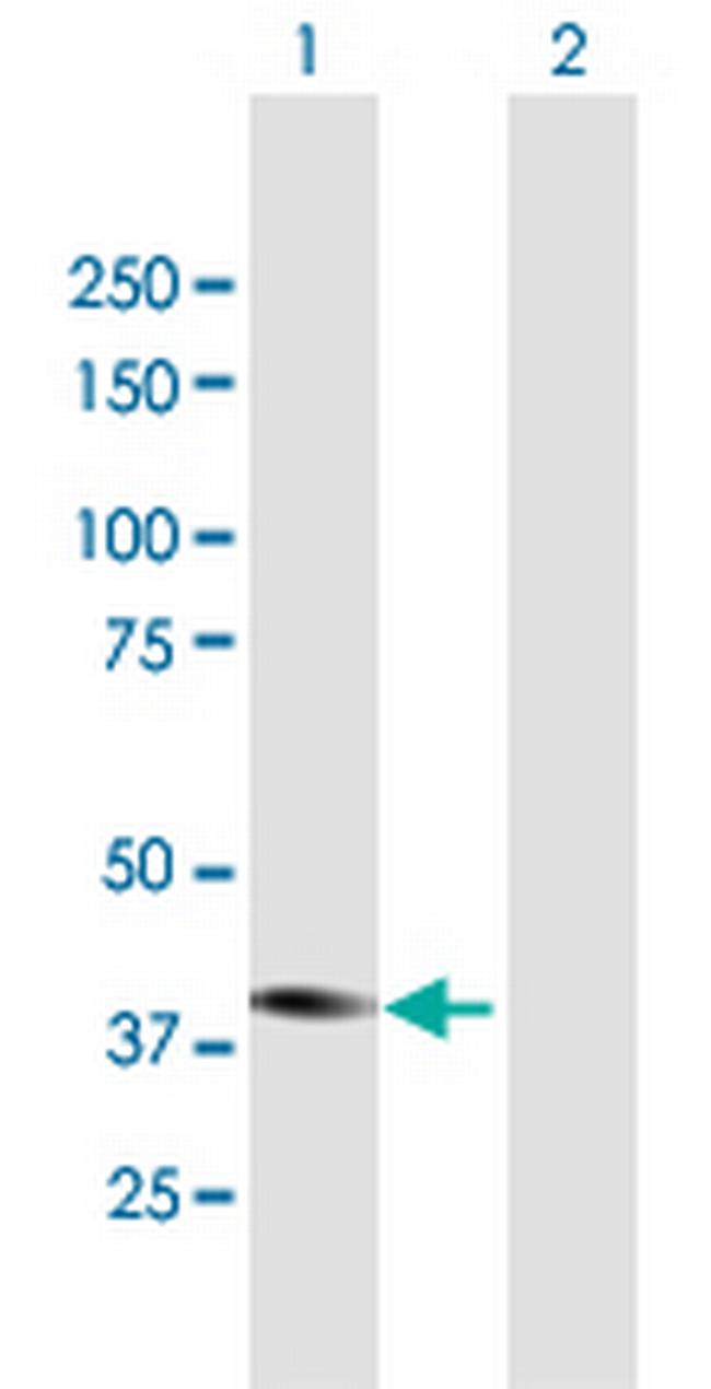 STYK1 Antibody in Western Blot (WB)
