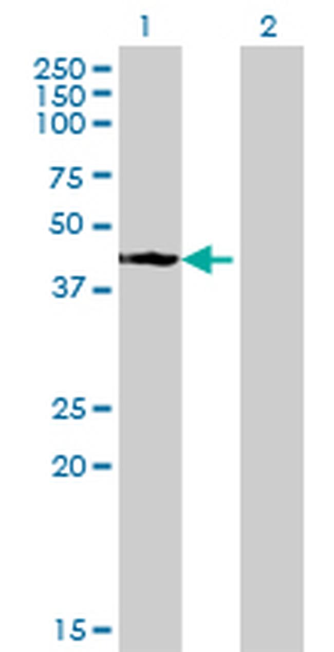 STYK1 Antibody in Western Blot (WB)