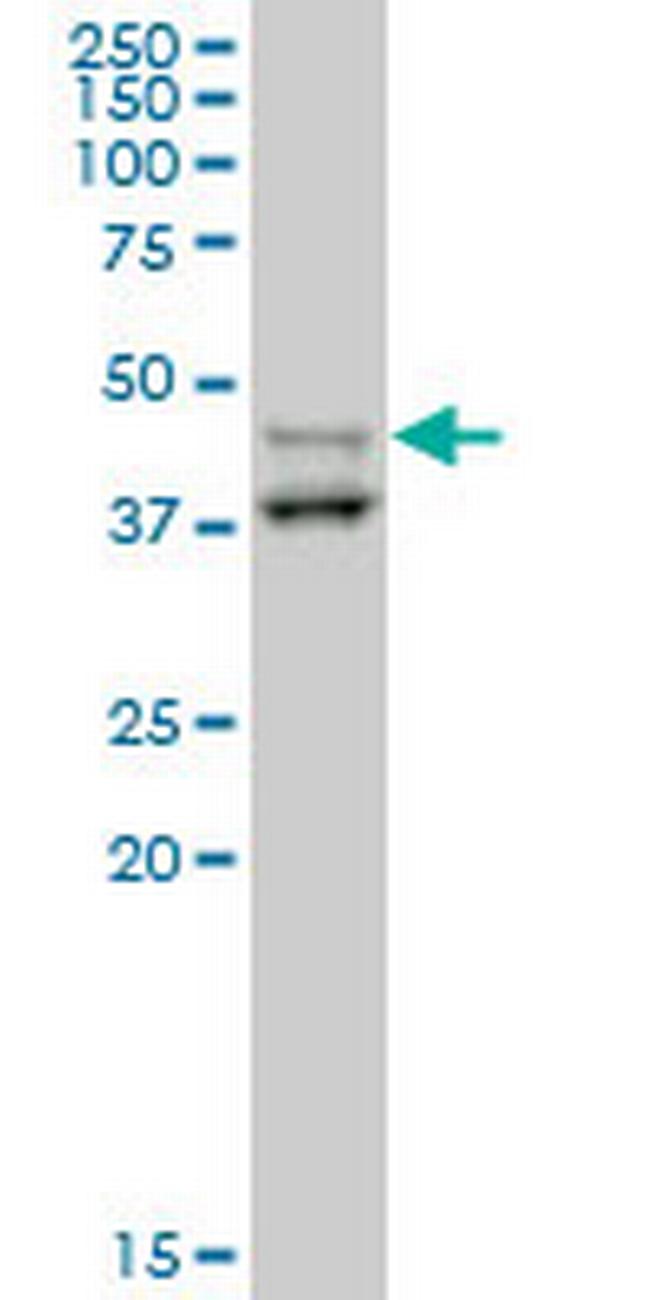 STYK1 Antibody in Western Blot (WB)