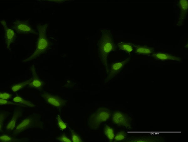 PI4K2A Antibody in Immunocytochemistry (ICC/IF)