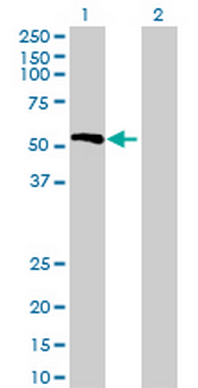 PPP4R1L Antibody in Western Blot (WB)