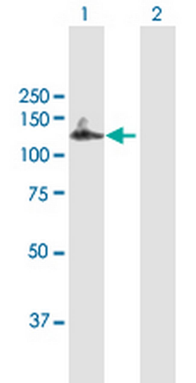 MCM10 Antibody in Western Blot (WB)
