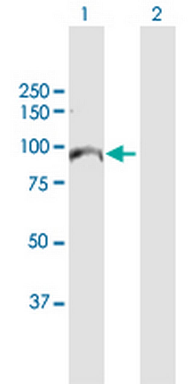 MCM10 Antibody in Western Blot (WB)