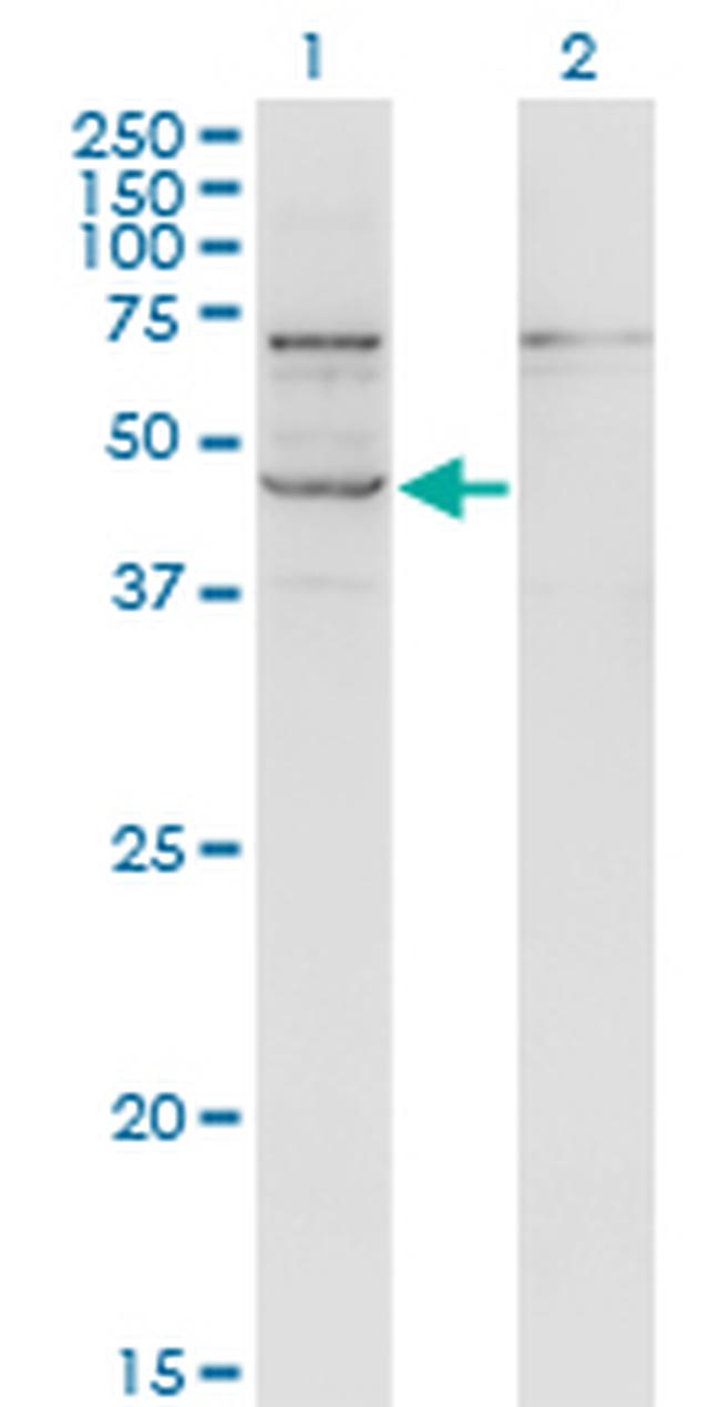 STRADB Antibody in Western Blot (WB)