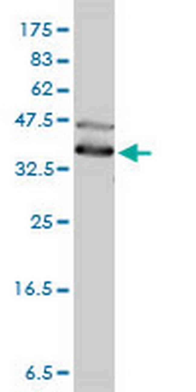 DNAJA4 Antibody in Western Blot (WB)