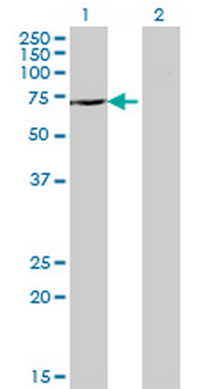 DDX43 Antibody in Western Blot (WB)