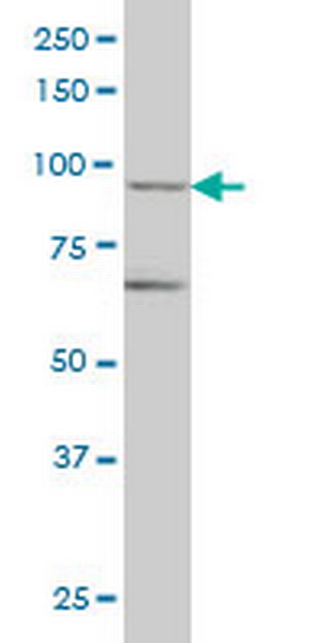 TRIM36 Antibody in Western Blot (WB)