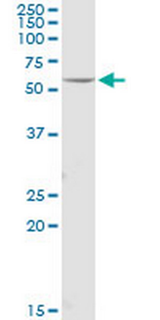 FOXRED1 Antibody in Western Blot (WB)