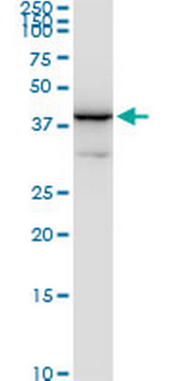 NAGK Antibody in Western Blot (WB)