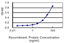 DDX60 Antibody in ELISA (ELISA)