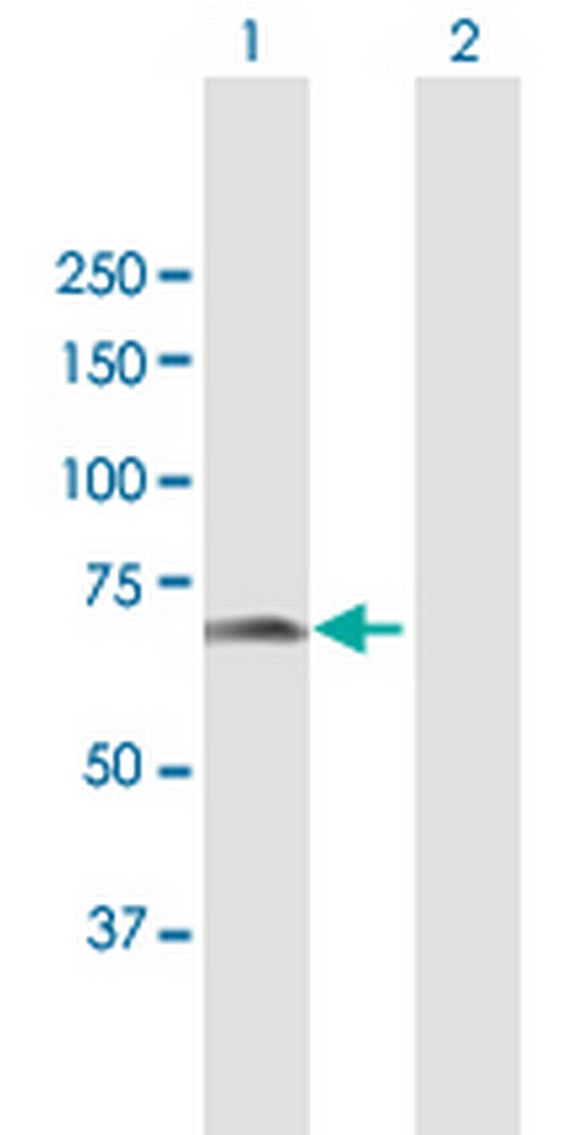 CDKN2AIP Antibody in Western Blot (WB)