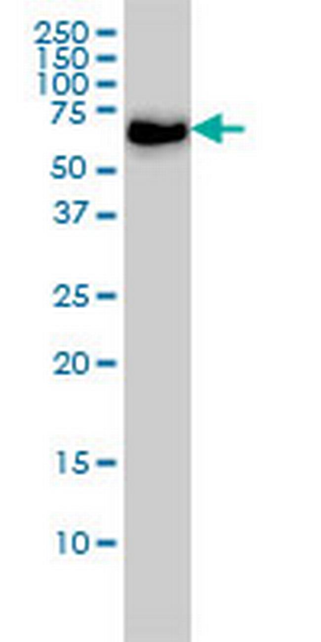 CARF Antibody in Western Blot (WB)