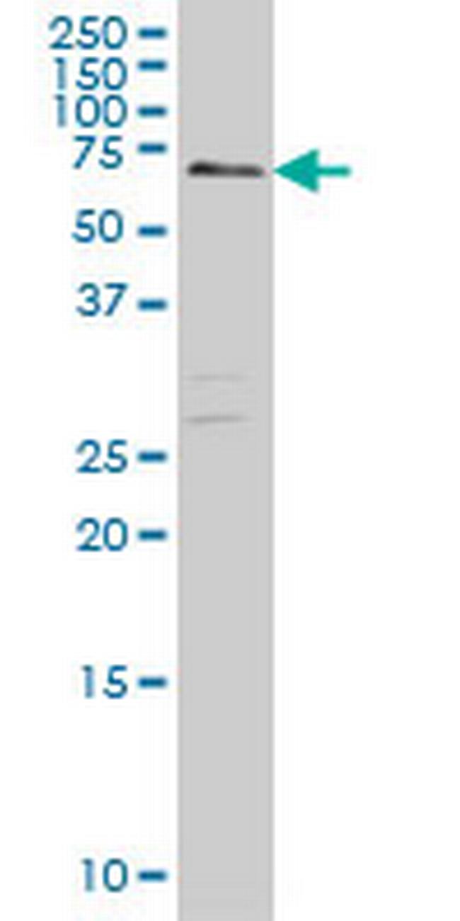 CARF Antibody in Western Blot (WB)