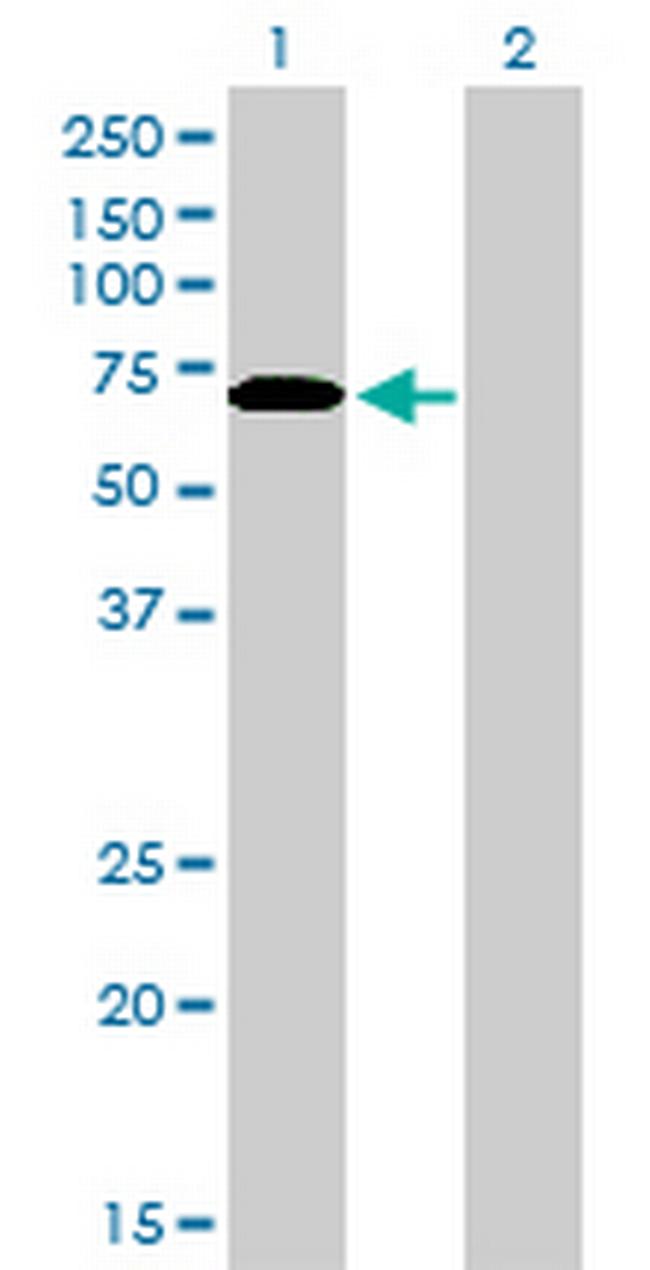 CARF Antibody in Western Blot (WB)