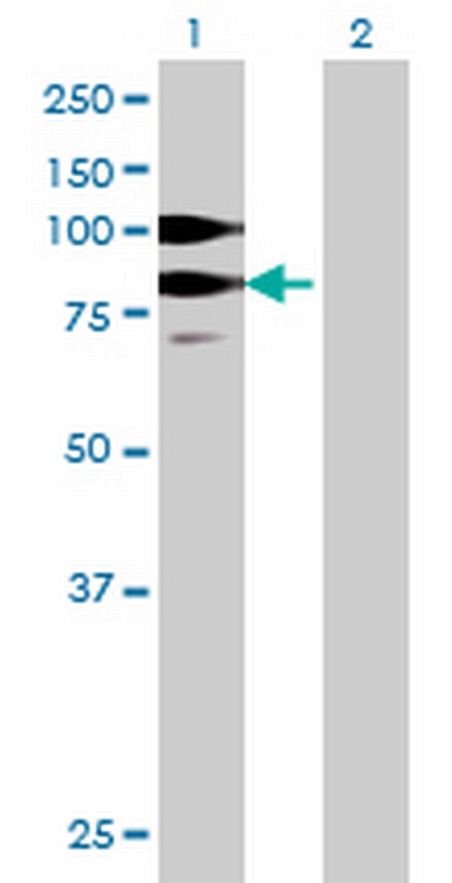 SUHW3 Antibody in Western Blot (WB)