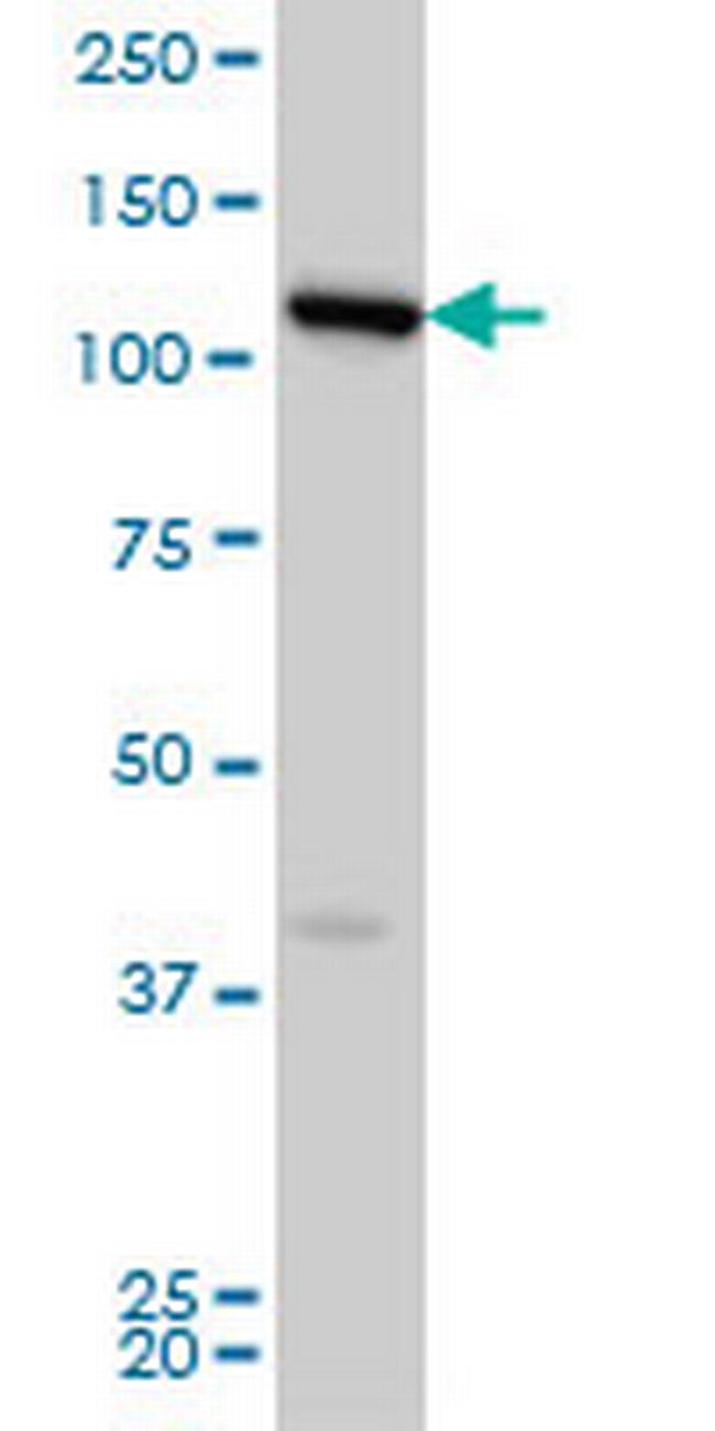 FLJ20097 Antibody in Western Blot (WB)