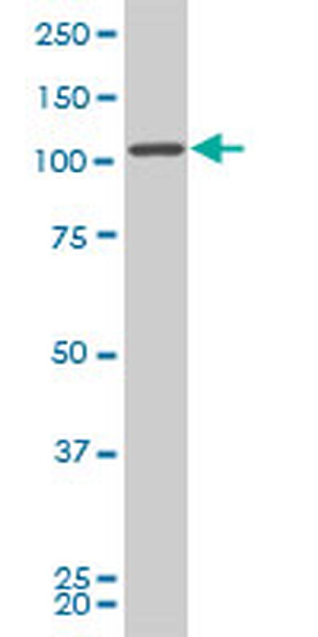 FLJ20097 Antibody in Western Blot (WB)