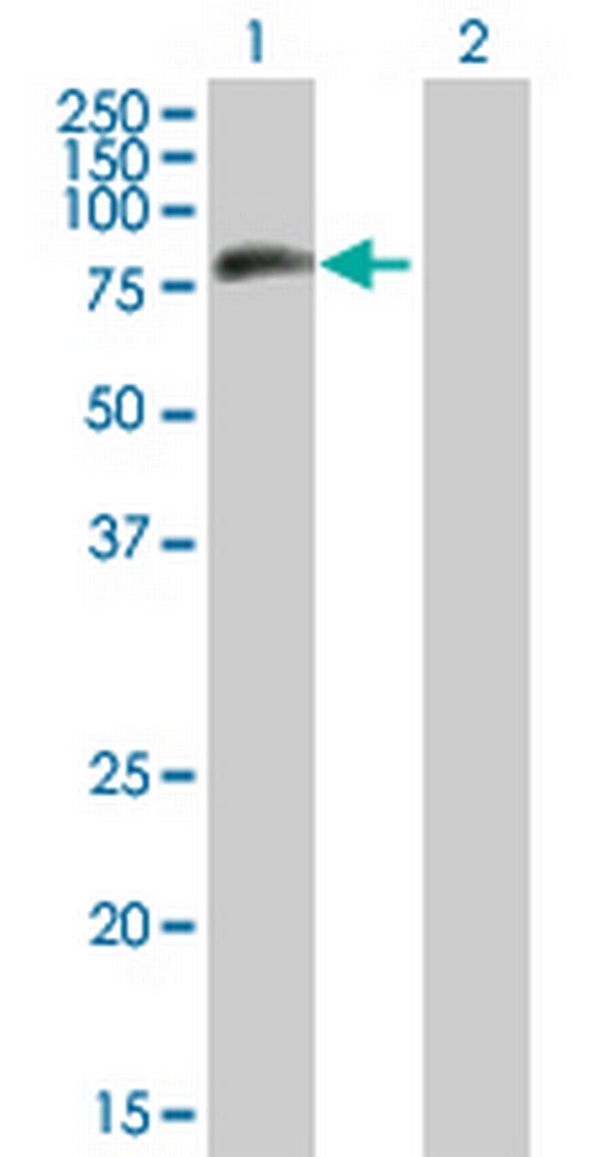 MTMR8 Antibody in Western Blot (WB)