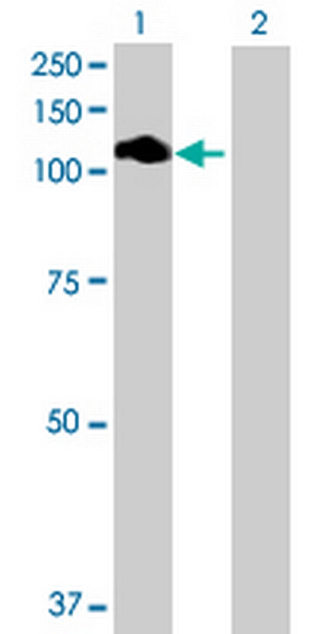 DDEFL1 Antibody in Western Blot (WB)