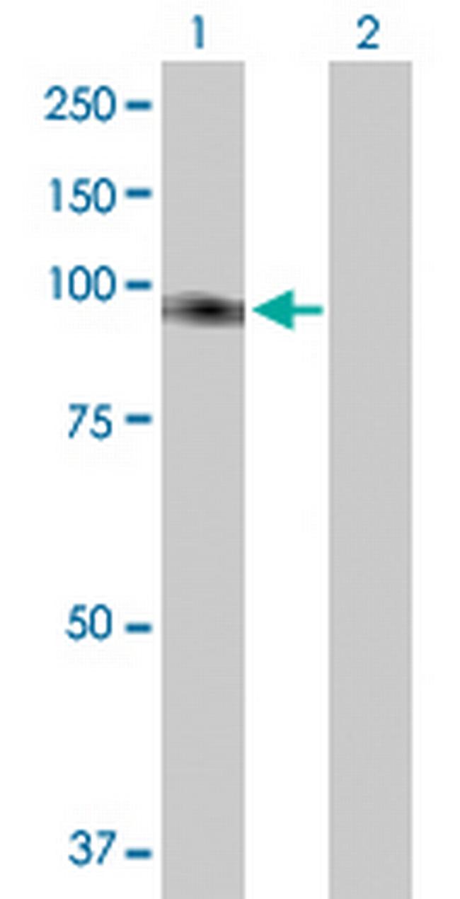 FLJ20272 Antibody in Western Blot (WB)