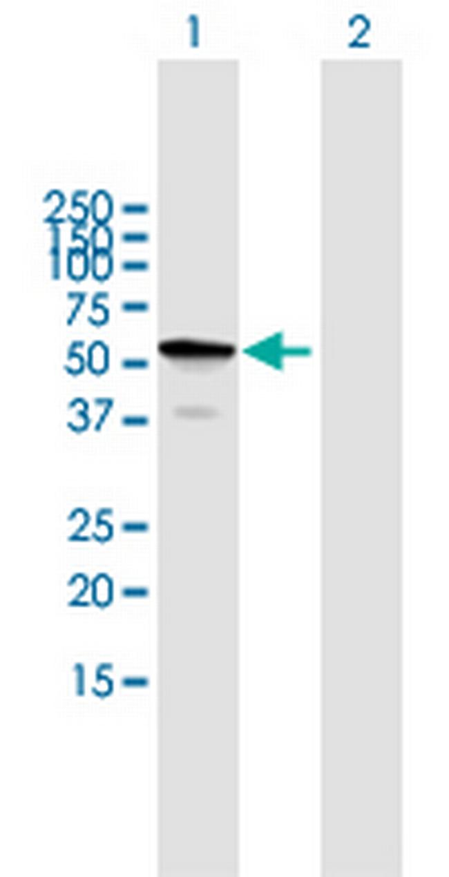 TBC1D22B Antibody in Western Blot (WB)