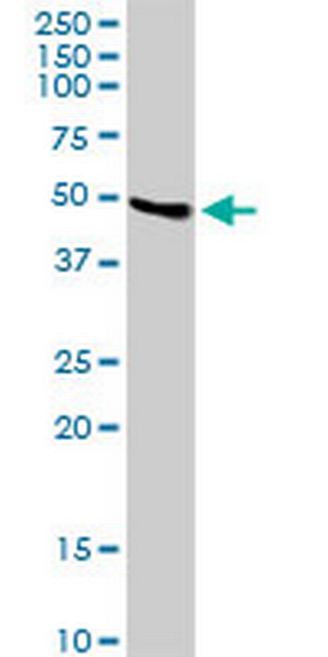LYAR Antibody in Western Blot (WB)