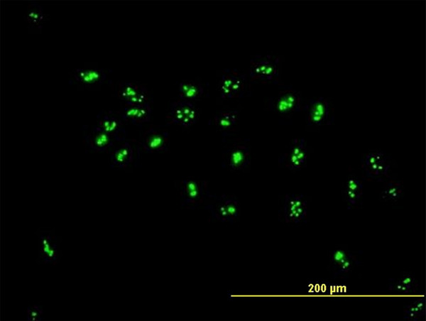 LYAR Antibody in Immunocytochemistry (ICC/IF)