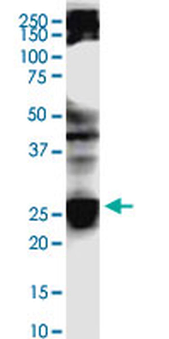 BCAS4 Antibody in Western Blot (WB)