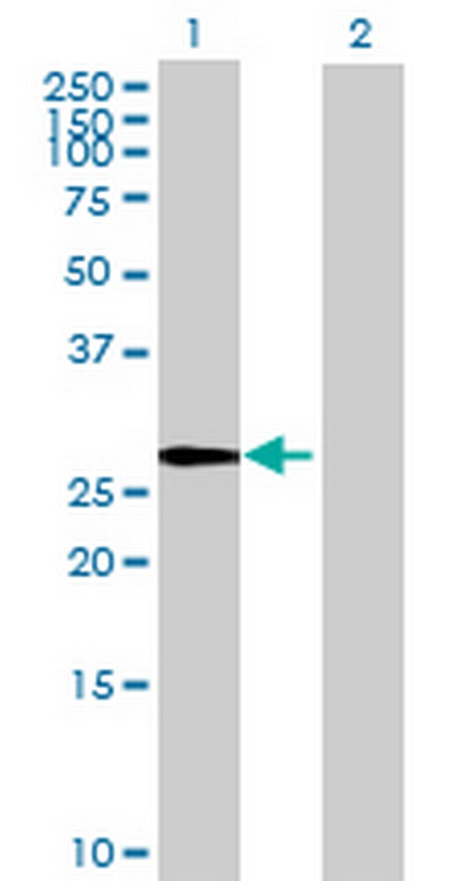 PRPF40A Antibody in Western Blot (WB)