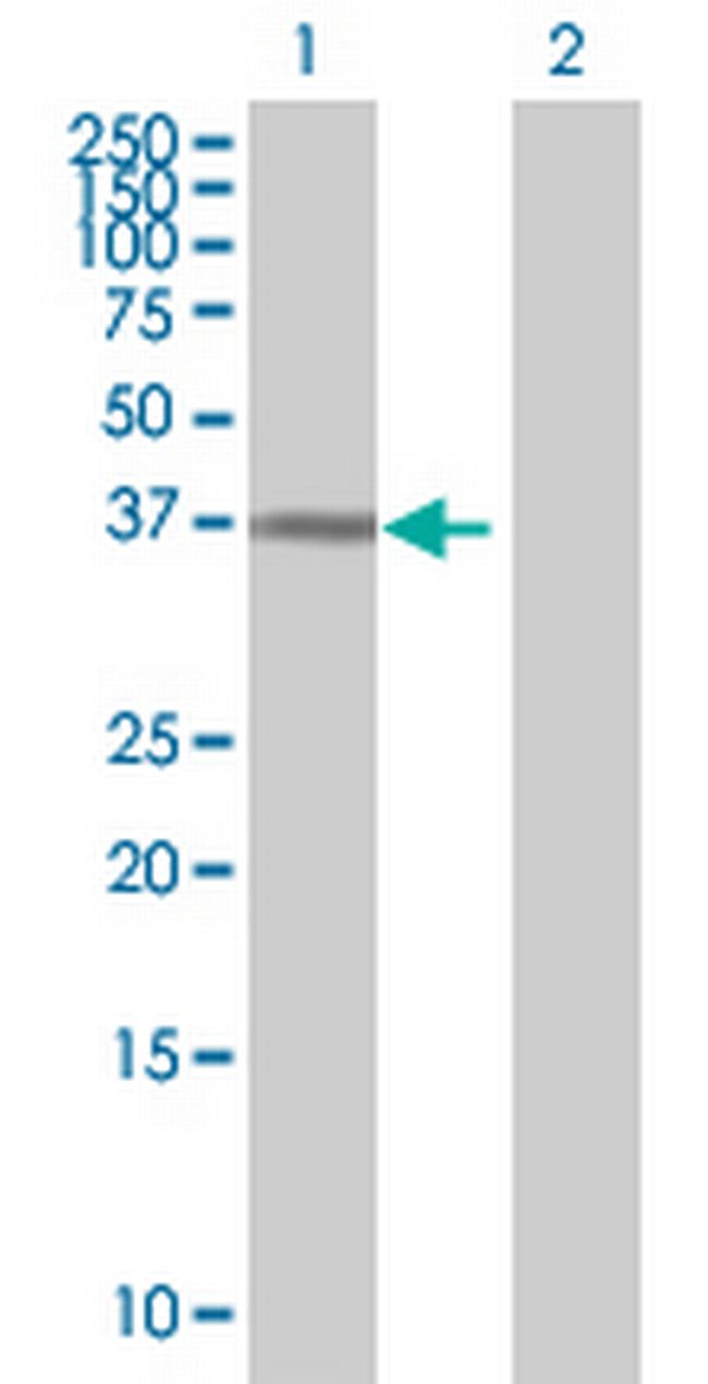 HIF1AN Antibody in Western Blot (WB)