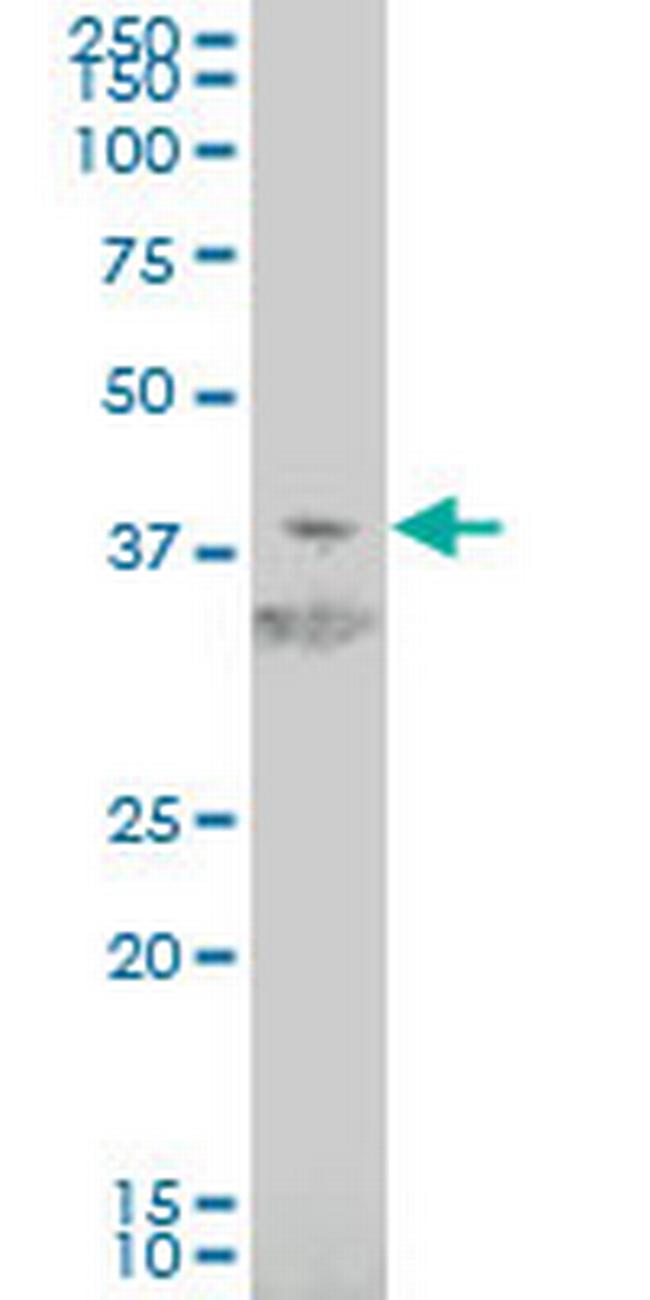 HIF1AN Antibody in Western Blot (WB)