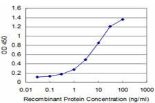 DSU Antibody in ELISA (ELISA)