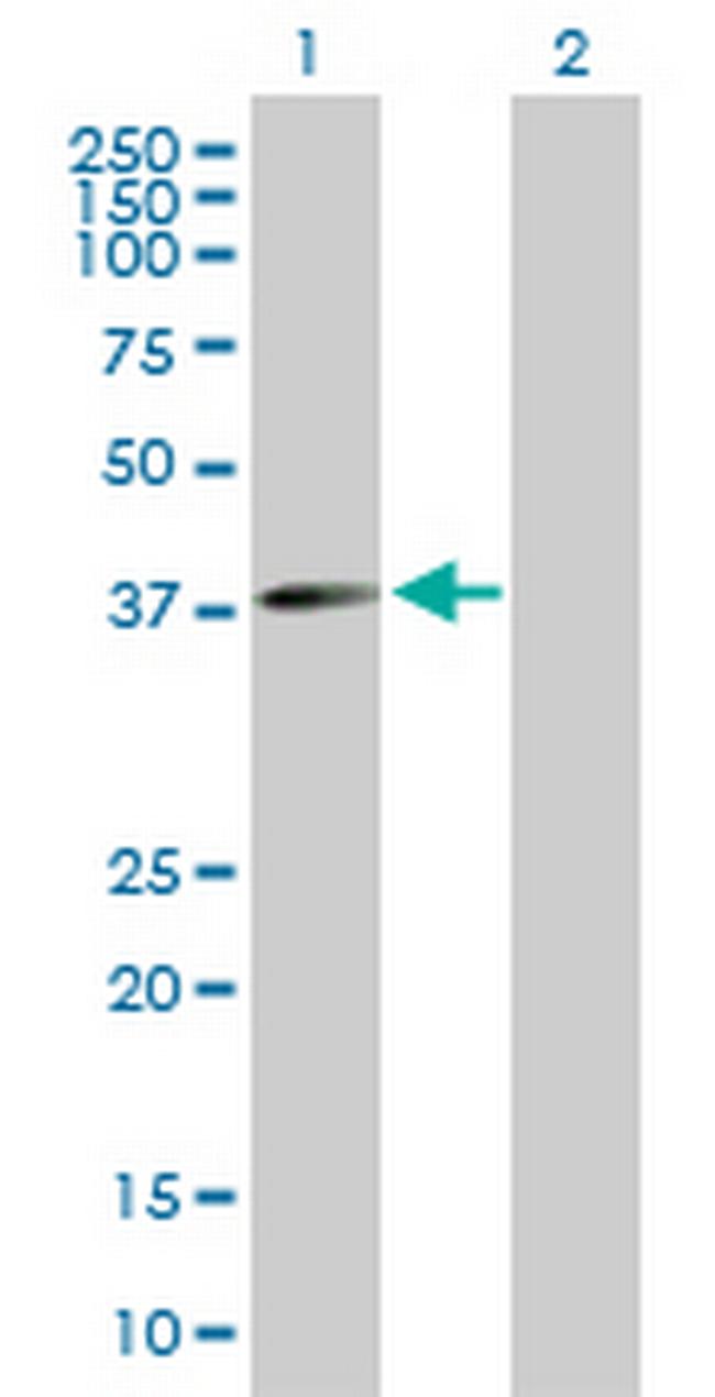 FLJ10357 Antibody in Western Blot (WB)