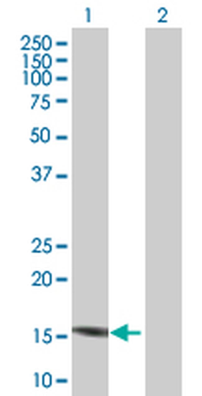 C7ORF44 Antibody in Western Blot (WB)