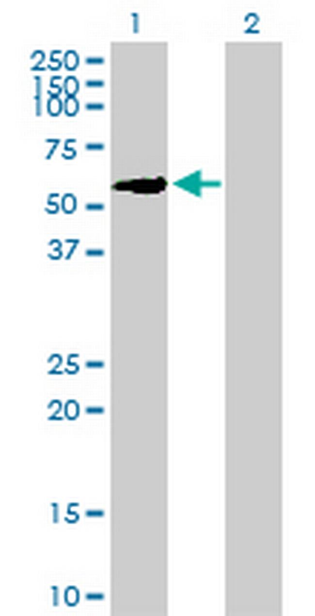 ZNF83 Antibody in Western Blot (WB)
