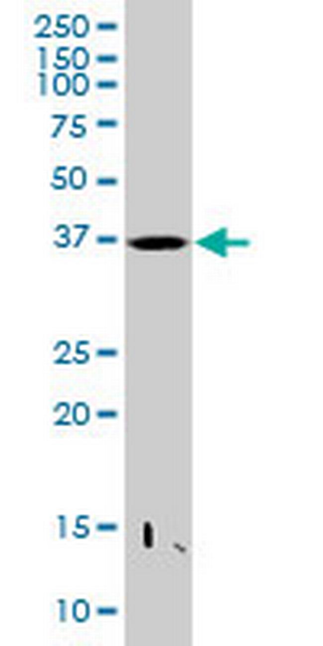 PRR11 Antibody in Western Blot (WB)