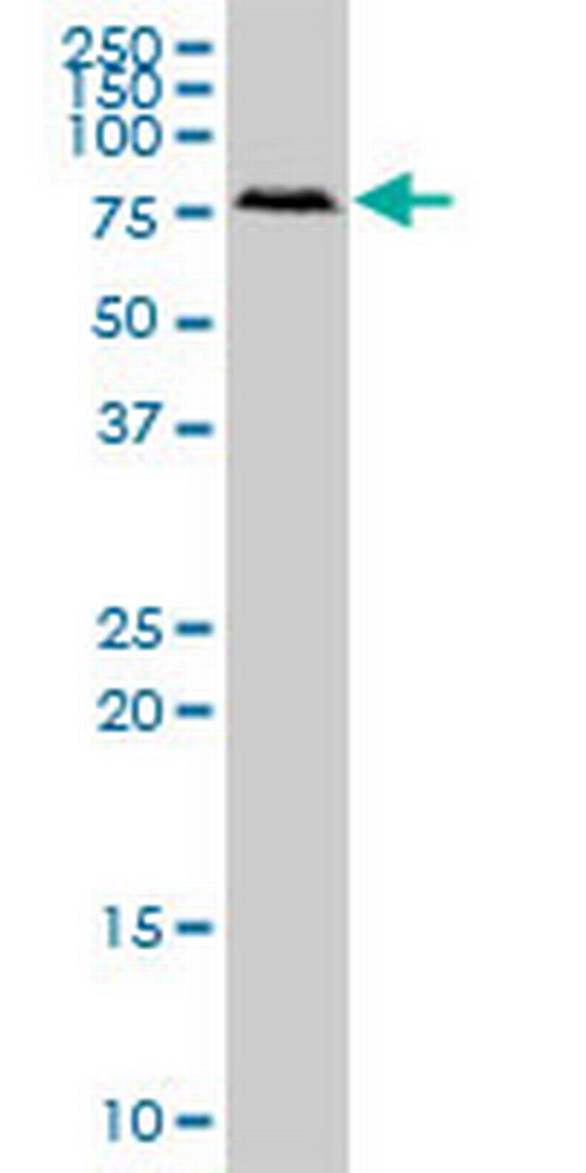 RIOK2 Antibody in Western Blot (WB)