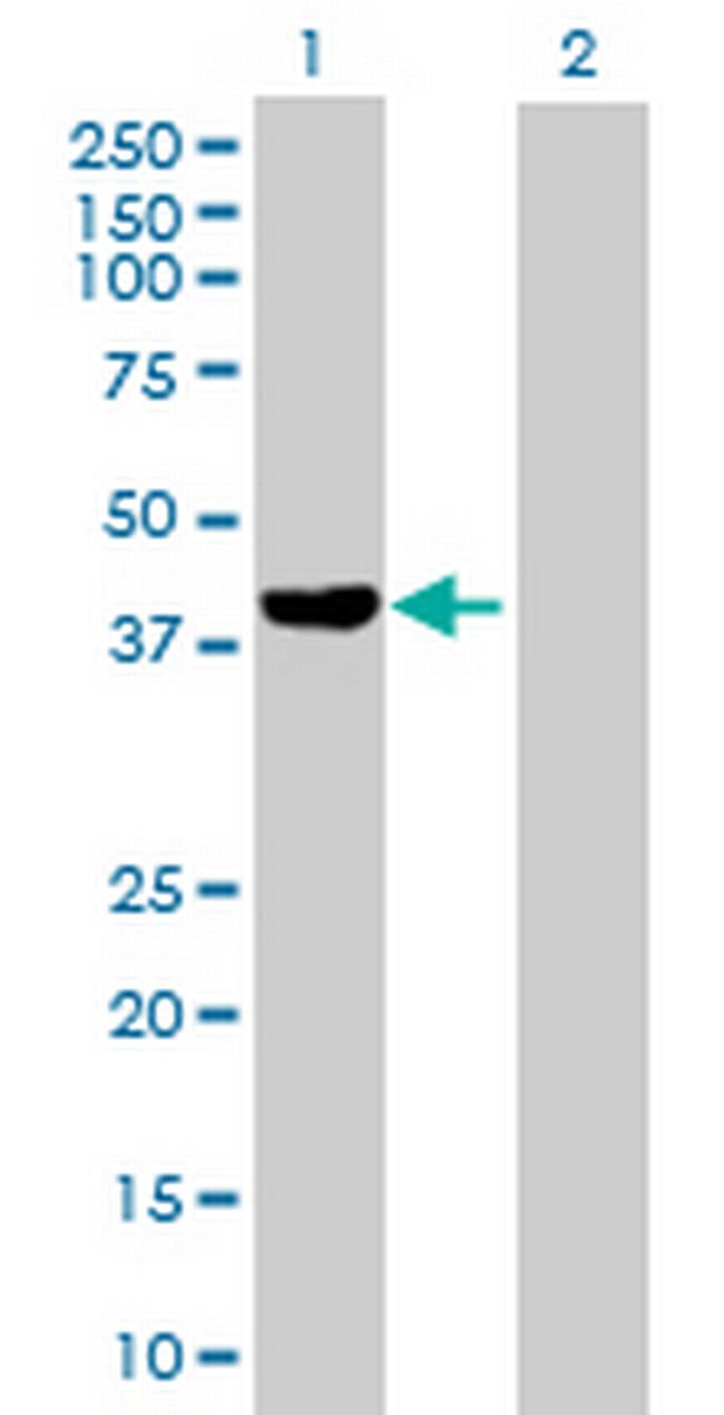 FGD6 Antibody in Western Blot (WB)