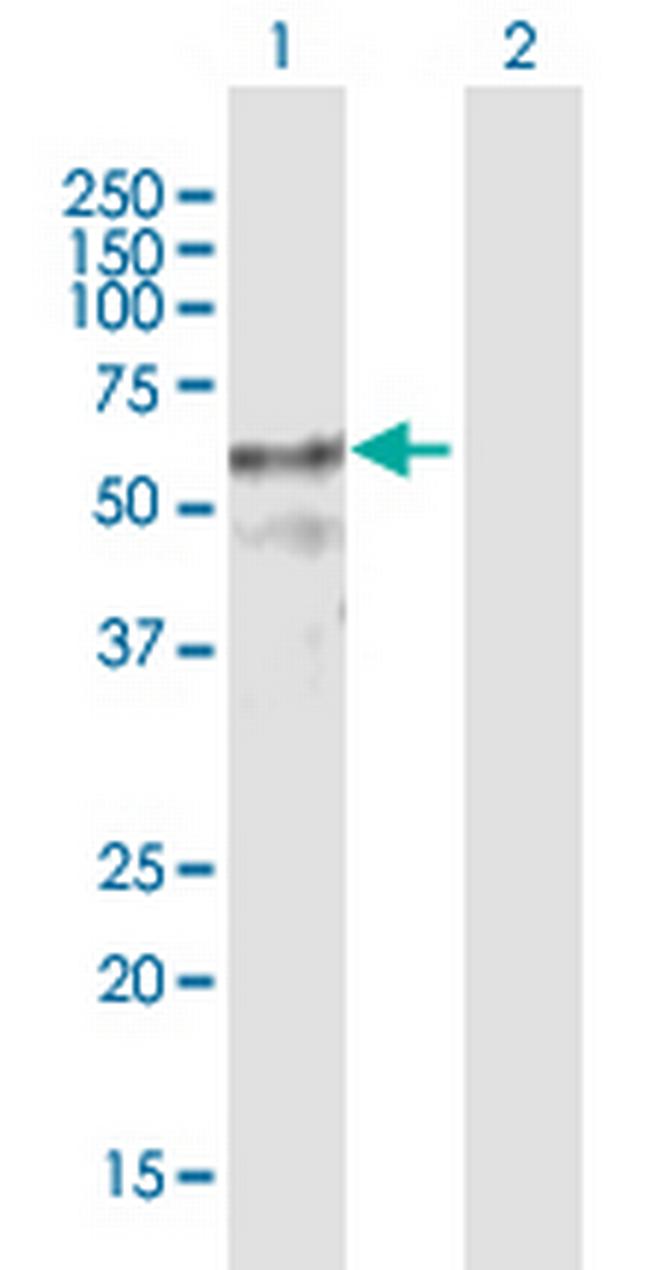 ZNF415 Antibody in Western Blot (WB)