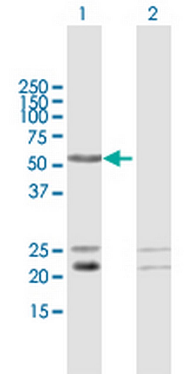C1orf103 Antibody in Western Blot (WB)