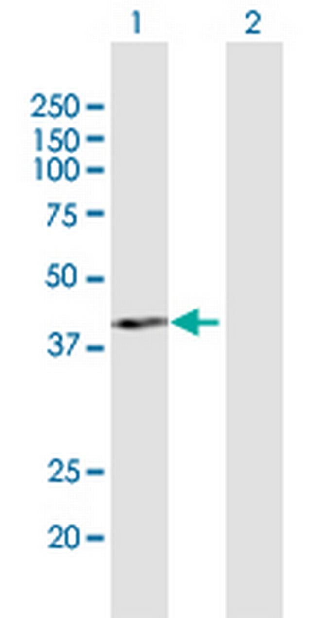 PCID2 Antibody in Western Blot (WB)