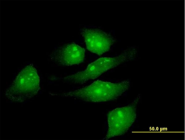 METTL2 Antibody in Immunocytochemistry (ICC/IF)