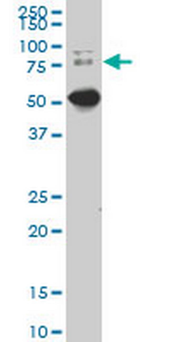 DCP1A Antibody in Western Blot (WB)