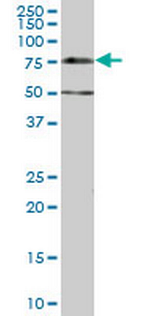 DCP1A Antibody in Western Blot (WB)