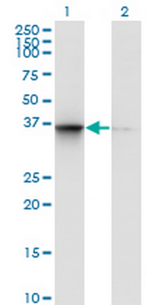 TSNAXIP1 Antibody in Western Blot (WB)