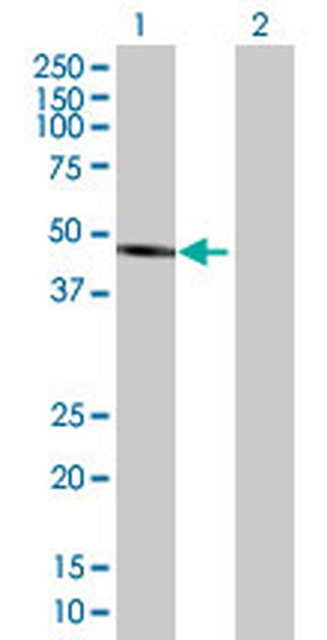ALLC Antibody in Western Blot (WB)