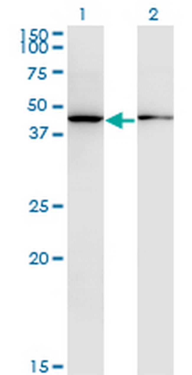 ALLC Antibody in Western Blot (WB)