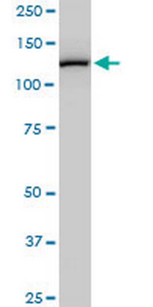 CAND1 Antibody in Western Blot (WB)