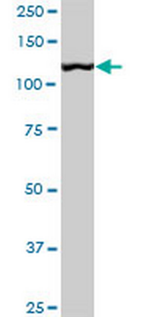 CAND1 Antibody in Western Blot (WB)