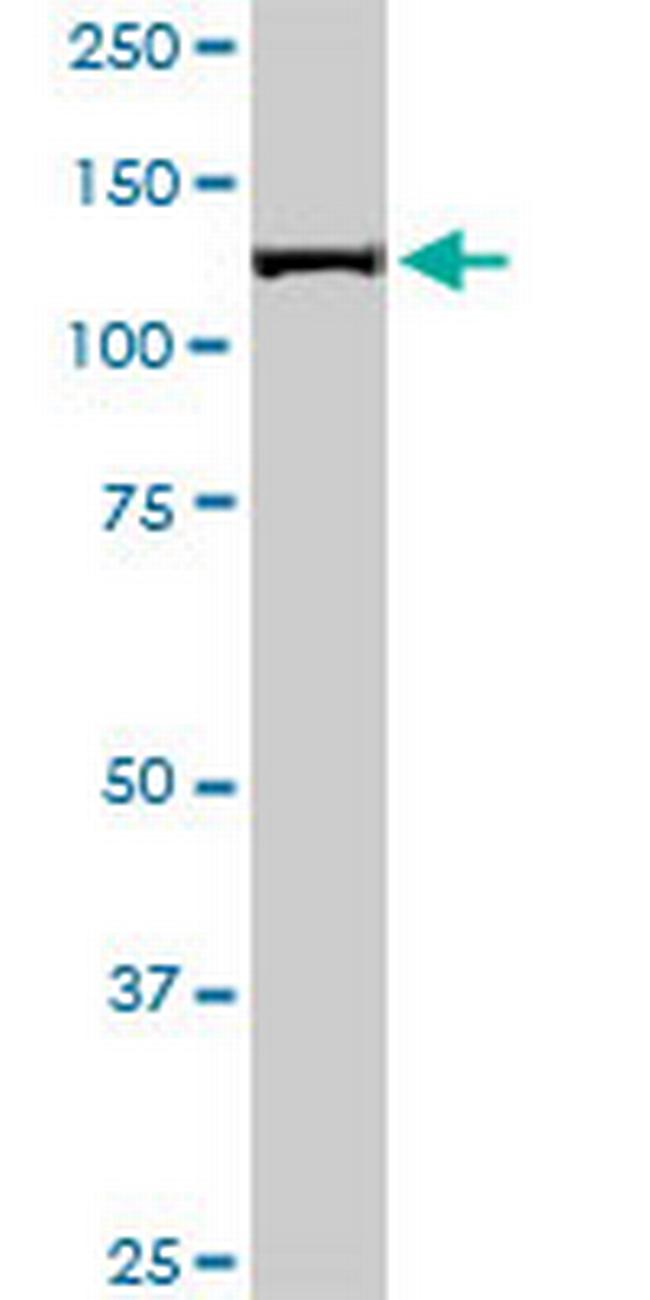 CAND1 Antibody in Western Blot (WB)